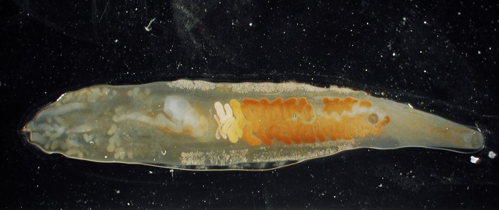 圖1：顯微鏡下的中華肝吸蟲