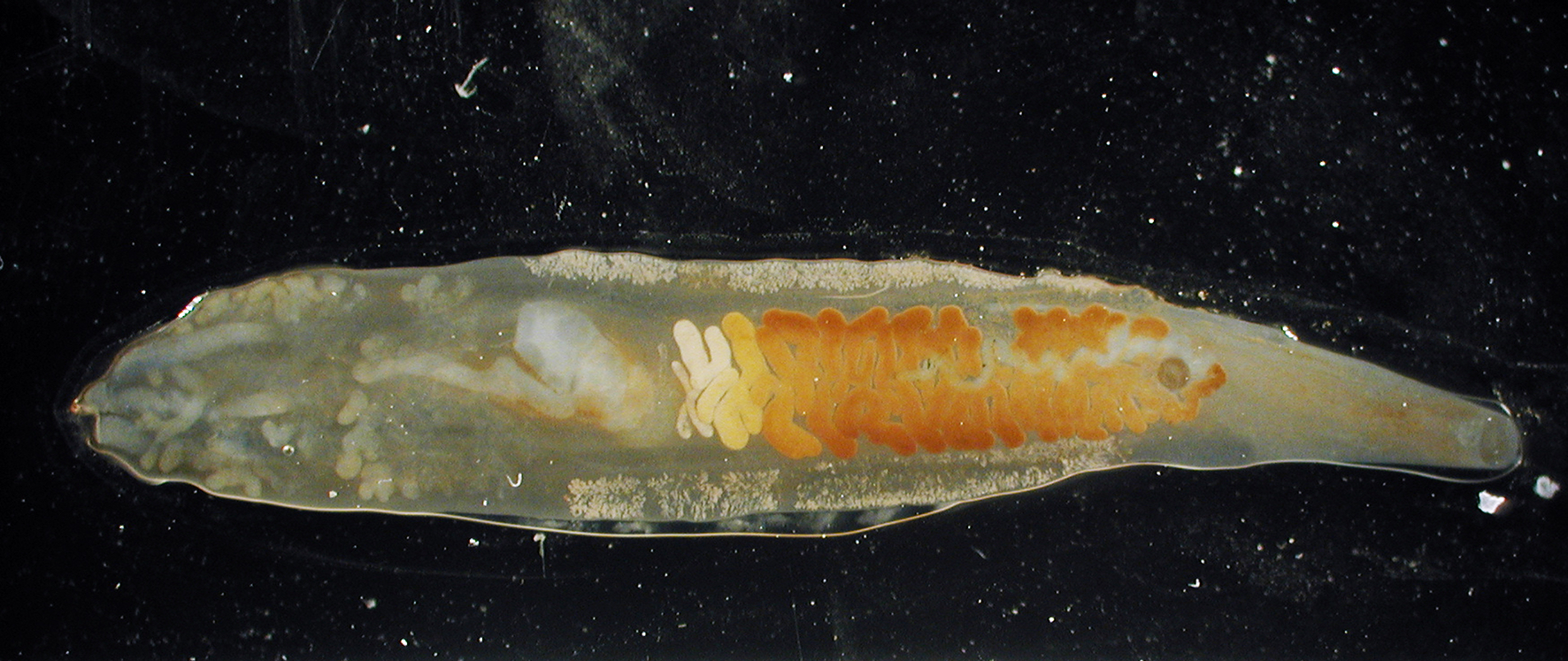 Clonorchis sinensis under microscope.