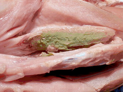 绿肌病:受影响肌肉呈现不常见的绿色